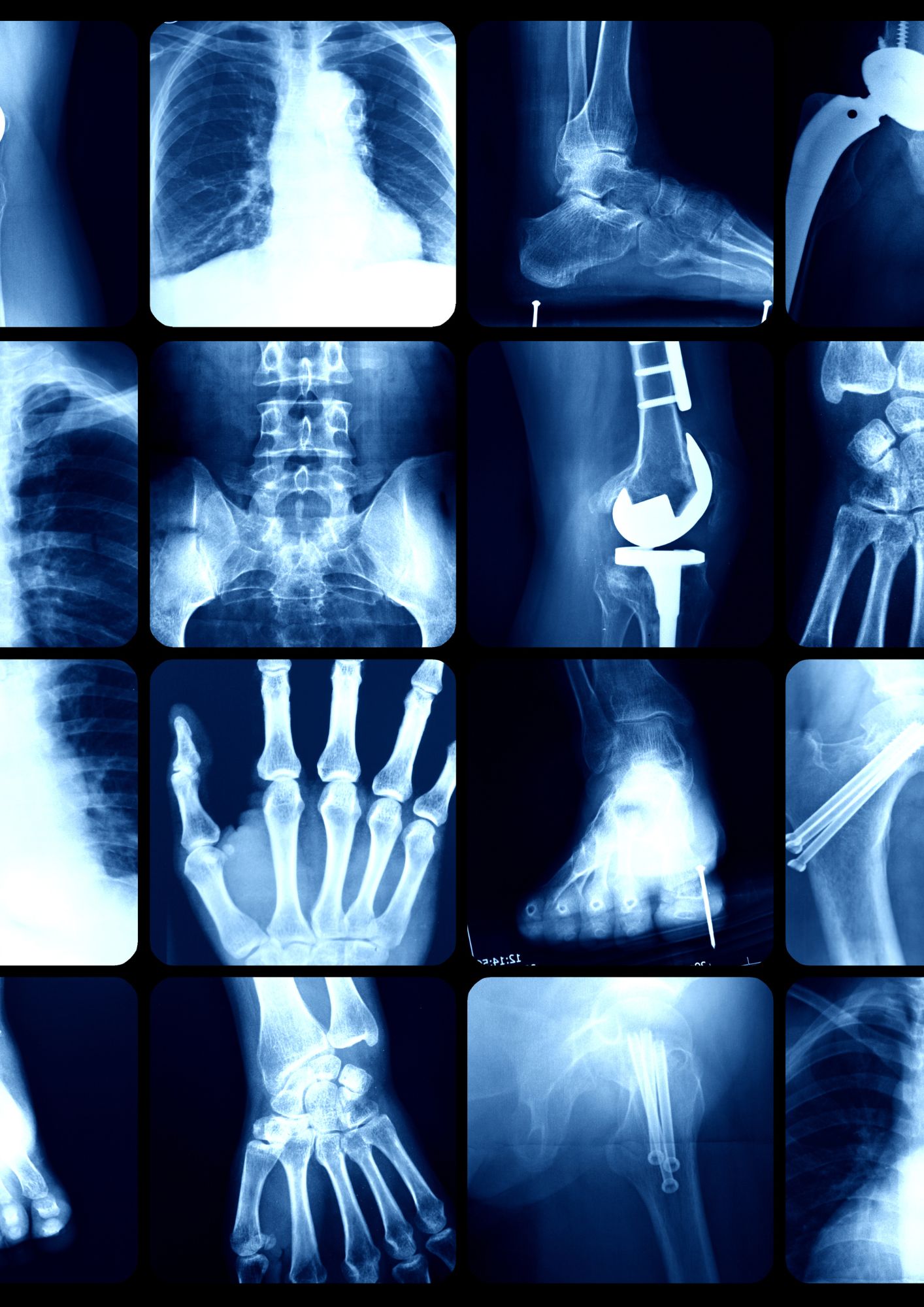 Badania ortopedyczne zabiegi